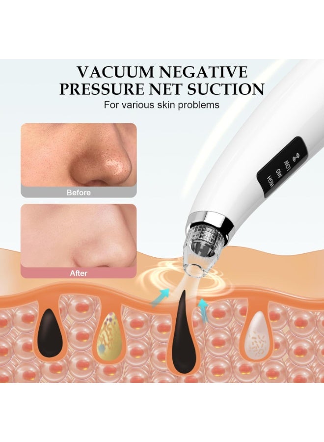 general Facial Pore Blackhead Remover Vacuum - Fore Cleaner and Blackhead Extractor with 3 Adjustable Suction Levels - 5 Probes - Pore Vacuum Kit for Women&Men (White) - Image 3